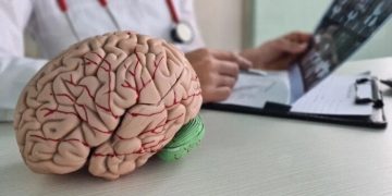 القصر العيني يعلن بدء استخدام الجيل الجديد من أدوية ذوبان الجلطات